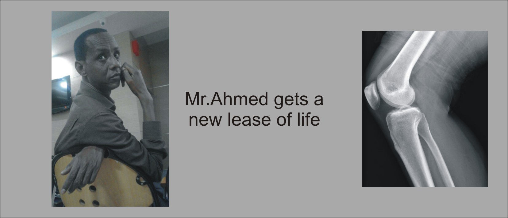 Bullet Injury patient gets a new lease of life Patient Stories my