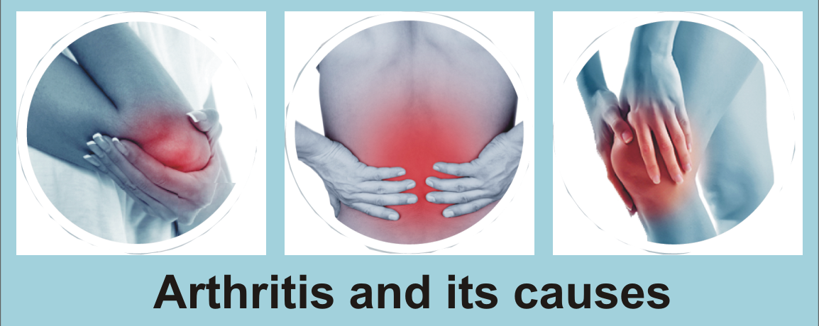 Arthritis and its causes, Osteoarthritis, Knee Pain, Back Pain