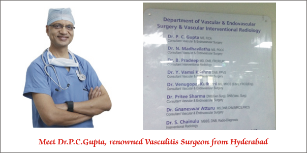 Deep Vein Thrombosis, Diabetic Foot, Varicose Veins, Vascular Surgeons in India, Vasculitis