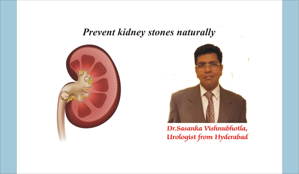 How to tell if you have kidney stones