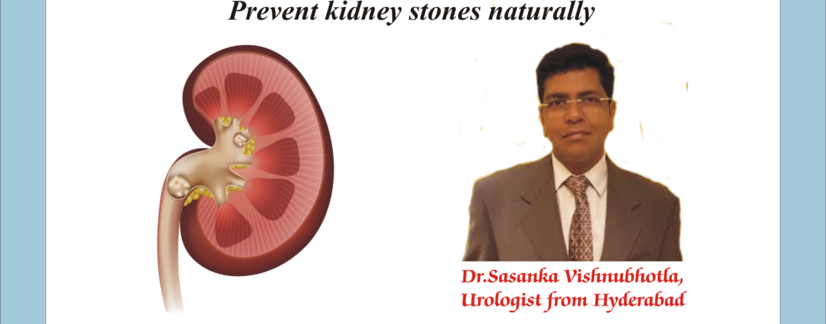 Best urologists in India, Kidney Stones, Kidney Stones treatment, Prevent Kidney Stones, Urologists in India
